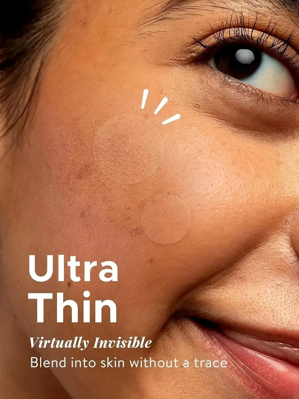 360pcs Face Acne Patch