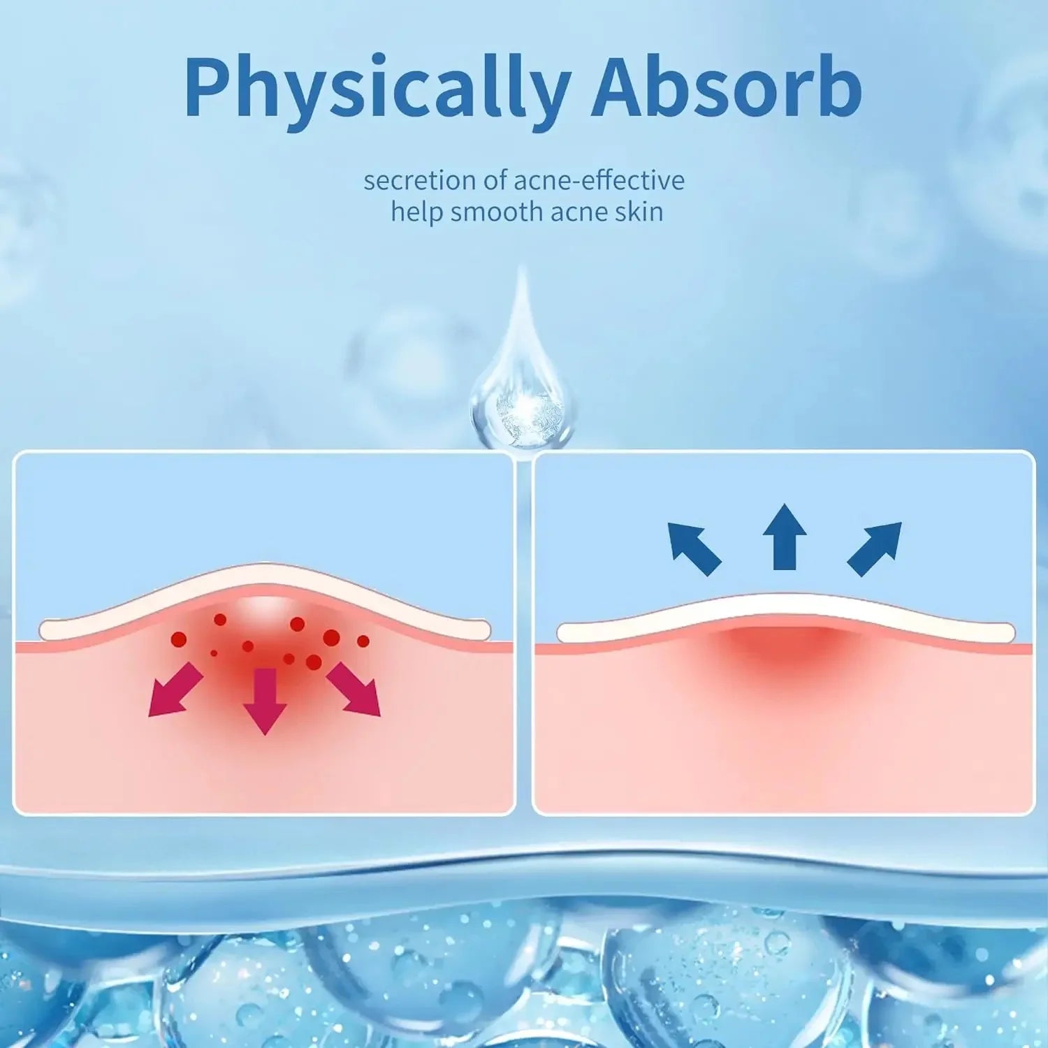 360pcs Face Acne Patch